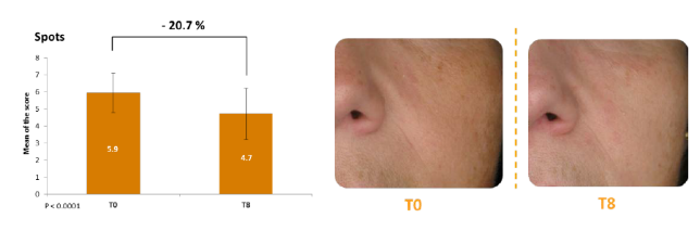 Công thức độc quyền SkinAx2TM: Khắc phục tình trạng da không đều màu
