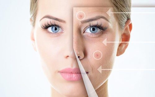 PHÂN PHỐI SỈ VIÊN UỐNG GIẢM MỤN CHÍNH HÃNG