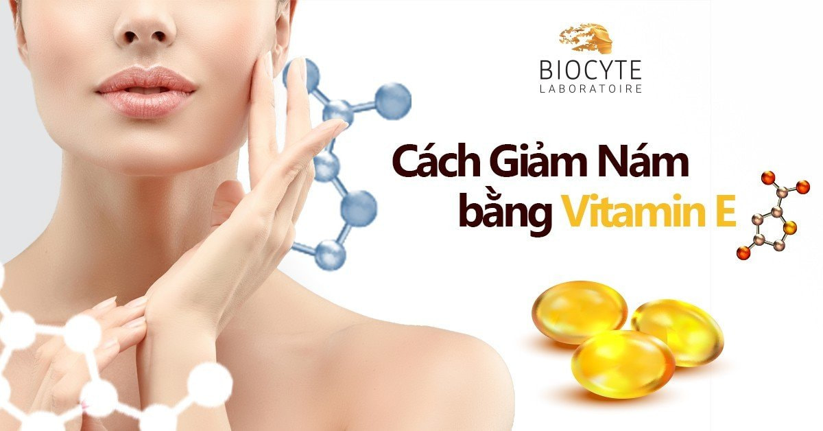 9 cách trị nám bằng vitamin E hiệu quả nhất 2023