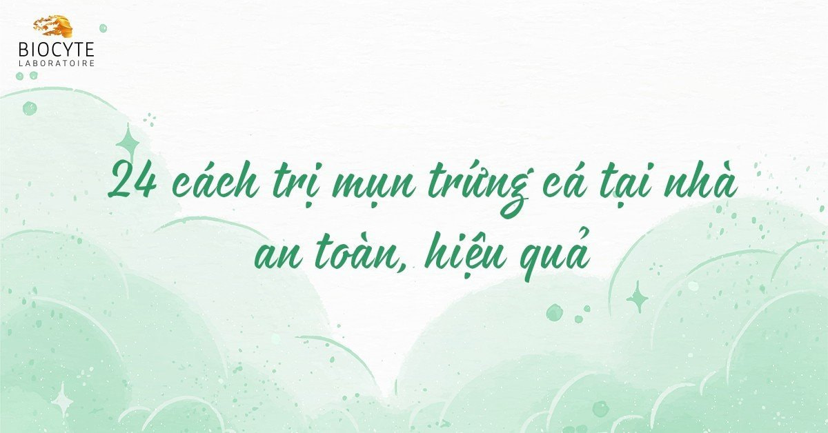 24 cách trị mụn trứng cá tại nhà an toàn, hiệu quả