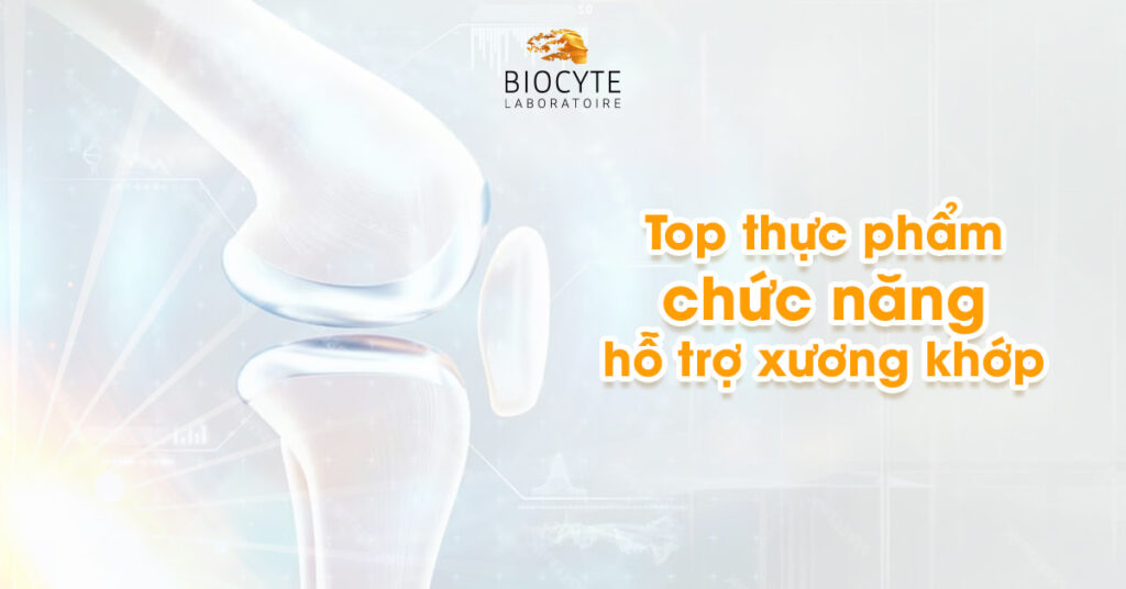 Top 20 thực phẩm chức năng hỗ trợ xương khớp