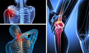 5 Thói Quen Âm Thầm Phá Hủy Khớp Trong Mùa Lạnh Bạn Cần Bỏ Ngay