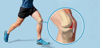 Nguyên Nhân Phổ Biến Gây Đau Khớp Gối Khi Chạy Bộ