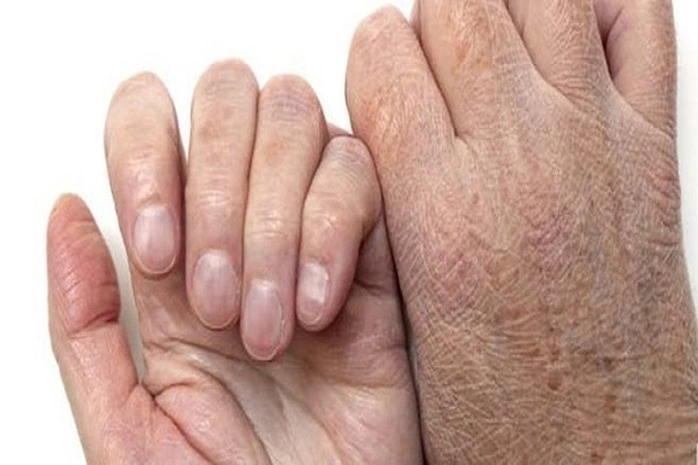khắc phục hiệu quả tình trạng da khô nứt nẻ mùa đông